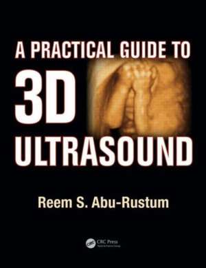 A Practical Guide to 3D Ultrasound de Reem S. Abu-Rustum