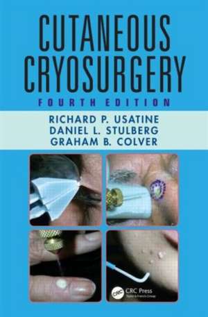 Cutaneous Cryosurgery de Richard P. Usatine