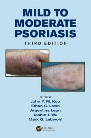 Mild to Moderate Psoriasis de John Koo