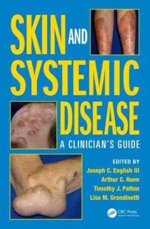 Skin and Systemic Disease: A Clinician's Guide de Joseph C. English III