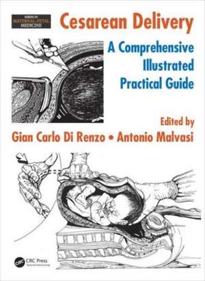 Cesarean Delivery: A Comprehensive Illustrated Practical Guide de Gian Carlo Di Renzo