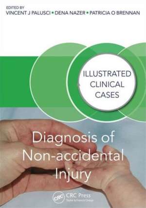 Diagnosis of Non-accidental Injury: Illustrated Clinical Cases de Vincent J. Palusci