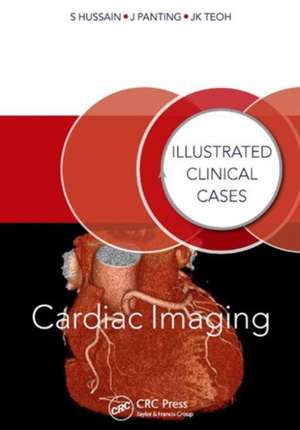 Cardiac Imaging: Illustrated Clinical Cases de Shahid Hussain