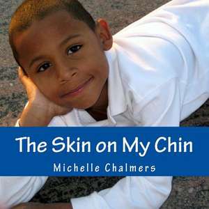 The Skin on My Chin de Michelle Chalmers