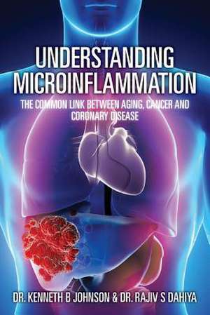 Understanding Microinflammation de Dr Kenneth B. Johnson