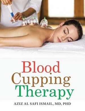 Blood Cupping Therapy de Md Ismail