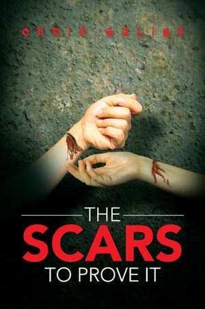 The Scars to Prove It de Chris Gulino