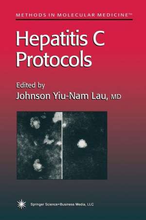 Hepatitis C Protocols de Johnson Y. N. Lau