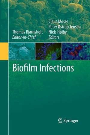 Biofilm Infections de Thomas Bjarnsholt