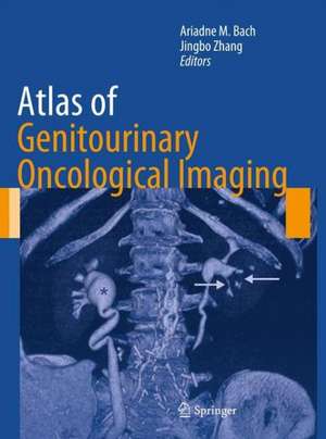 Atlas of Genitourinary Oncological Imaging de Ariadne M. Bach