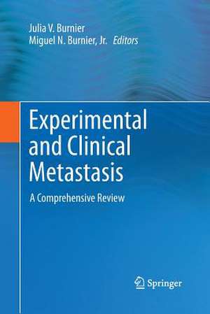 Experimental and Clinical Metastasis: A Comprehensive Review de Julia V. Burnier