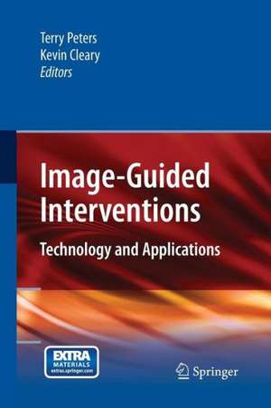 Image-Guided Interventions: Technology and Applications de Terry Peters