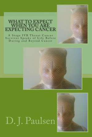 What to Expect When You Are Expecting Cancer de D. J. Paulsen