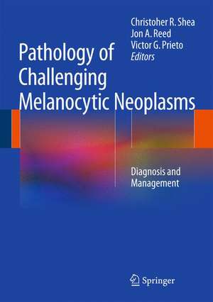 Pathology of Challenging Melanocytic Neoplasms: Diagnosis and Management de Christopher R. Shea