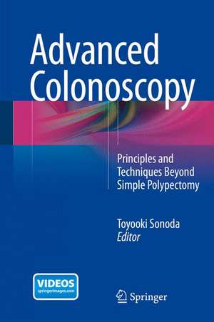 Advanced Colonoscopy: Principles and Techniques Beyond Simple Polypectomy de Toyooki Sonoda