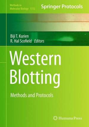 Western Blotting: Methods and Protocols de Biji T. Kurien