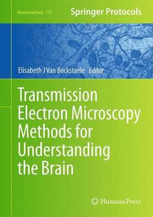 Transmission Electron Microscopy Methods for Understanding the Brain de Elisabeth J. Van Bockstaele