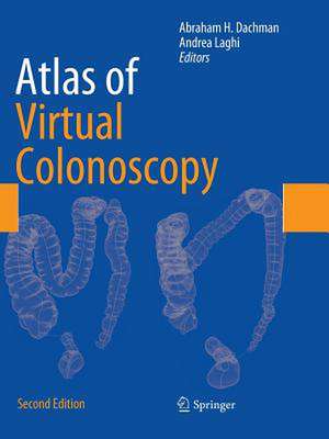 Atlas of Virtual Colonoscopy de Abraham H. Dachman