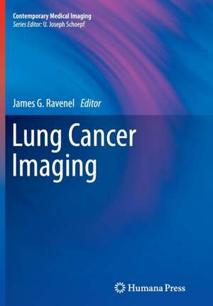 Lung Cancer Imaging de James G. Ravenel