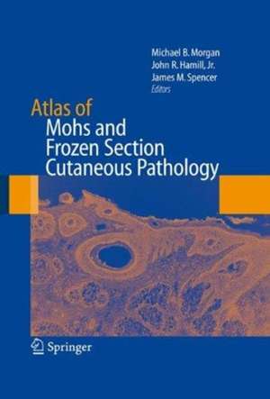 Atlas of Mohs and Frozen Section Cutaneous Pathology de Michael Morgan