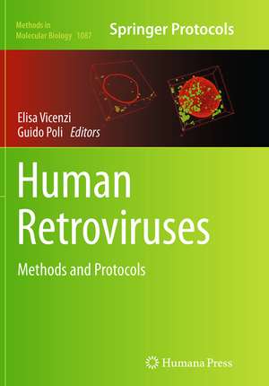 Human Retroviruses de Elisa Vicenzi