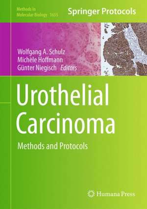 Urothelial Carcinoma: Methods and Protocols de Wolfgang A Schulz