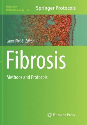 Fibrosis: Methods and Protocols de Laure Rittié