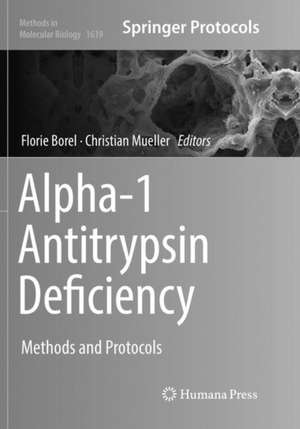 Alpha-1 Antitrypsin Deficiency: Methods and Protocols de Florie Borel