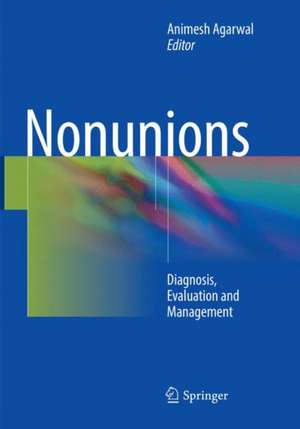 Nonunions: Diagnosis, Evaluation and Management de Animesh Agarwal