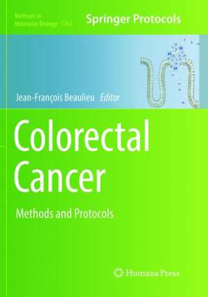 Colorectal Cancer: Methods and Protocols de Jean-François Beaulieu