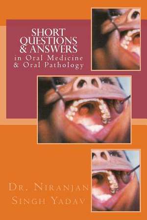 Short Questions & Answers in Oral Medicine & Oral Pathology de Niranjan Singh Yadav