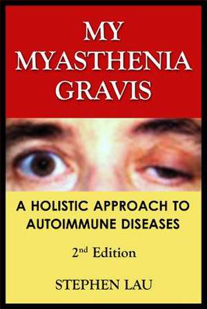 My Myasthenia Gravis de Stephen Lau