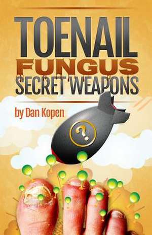 Toenail Fungus Secret Weapons de Dan Kopen