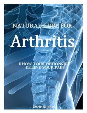 Natural Cure for Arthritis de Melissa Jones