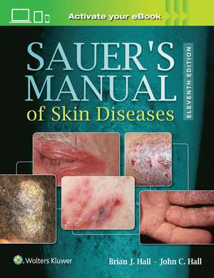 Sauer's Manual of Skin Diseases de Dr. John C. Hall