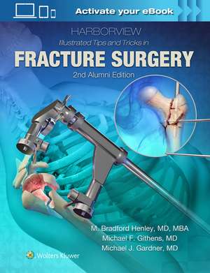 Harborview Illustrated Tips and Tricks in Fracture Surgery de M. Henley MD