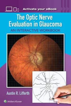 The Optic Nerve Evaluation in Glaucoma: An Interactive Workbook de Austin Lifferth