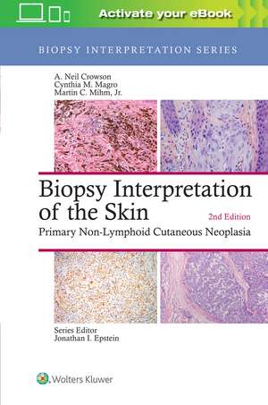 Biopsy Interpretation of the Skin: Primary Non-Lymphoid Cutaneous Neoplasia de A. Neil Crowson MD