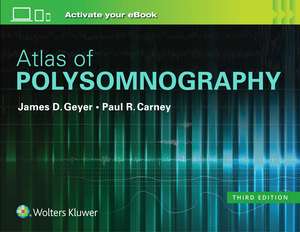 Atlas of Polysomnography alte