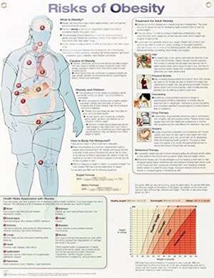 Risks of Obesity Anatomical Chart Laminated de Anatomical Chart Company