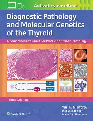 Diagnostic Pathology and Molecular Genetics of the Thyroid: A Comprehensive Guide for Practicing Thyroid Pathology de Yuri E. Nikiforov MD, PhD