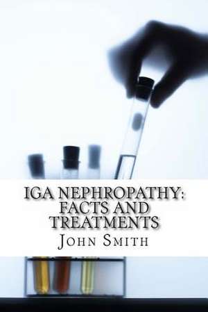 IGA Nephropathy de John Smith Ma