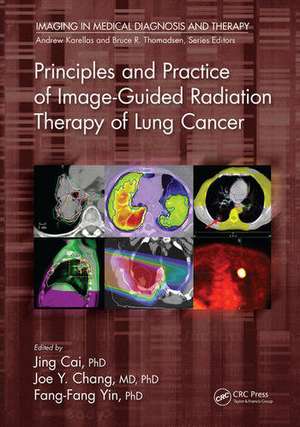 Principles and Practice of Image-Guided Radiation Therapy of Lung Cancer de Jing Cai