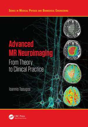 Advanced MR Neuroimaging: From Theory to Clinical Practice de Ioannis Tsougos