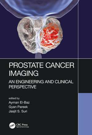 Prostate Cancer Imaging: An Engineering and Clinical Perspective de Ayman El-Baz