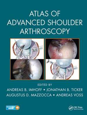 Atlas of Advanced Shoulder Arthroscopy de Andreas B. Imhoff