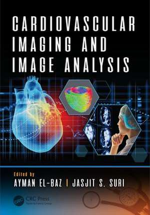 Cardiovascular Imaging and Image Analysis de Ayman El-Baz