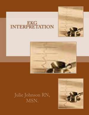 EKG Interpretation de Msn Julie Johnson Rn