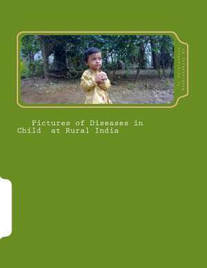 Pictures of Diseases in Child at Rural India de Dr Rajatsubhra Mukhopadhyay MD