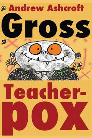 Gross Teacherpox B/W de Andrew Ashcroft